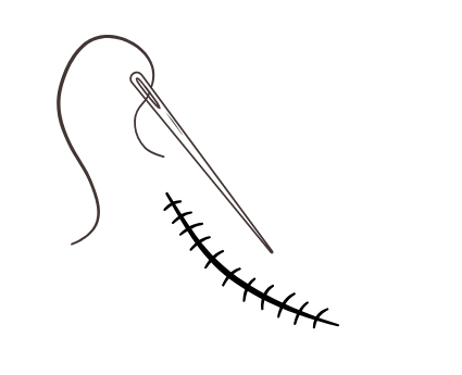 Illustration of a needle with needle and thread above a stitch